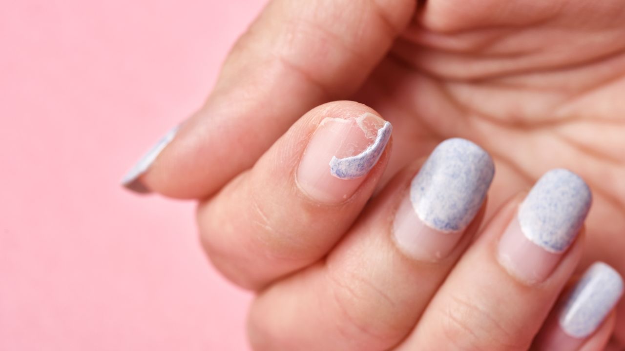 Como identificar se unhas fracas indicam uma doença